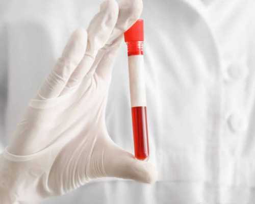 代孕专业的公司~为什么长时间不来月经（生化妊娠后不来月经）